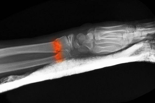 含碘造影剂是什么？碘造影剂的特点、分类及龙头企业介绍