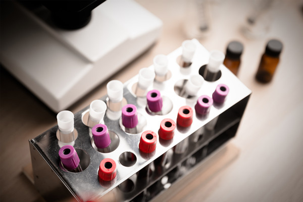 什么是血液制品？类型及概念股龙头一览