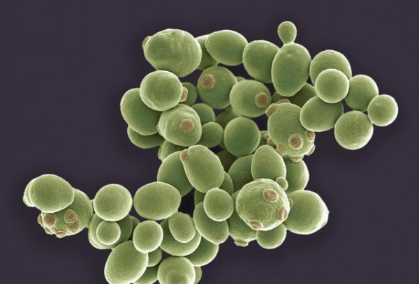 酵母是什么意思？和泡打粉的区别在哪？行业产品及其应用领域介绍