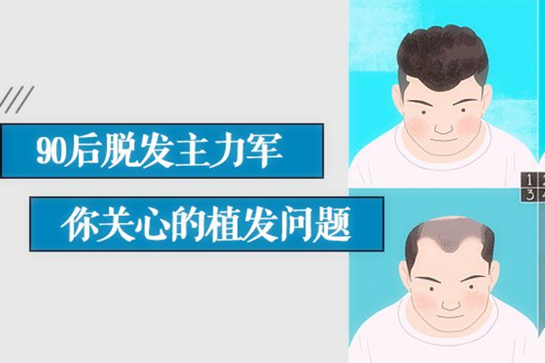 植发行业竞争格局